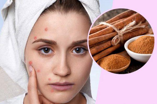 خواص درمانی دارچین